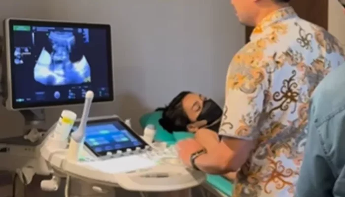 Erika Carlina Unggah Momen USG, Akui Kehamilan 9 Bulan di Luar Pernikahan